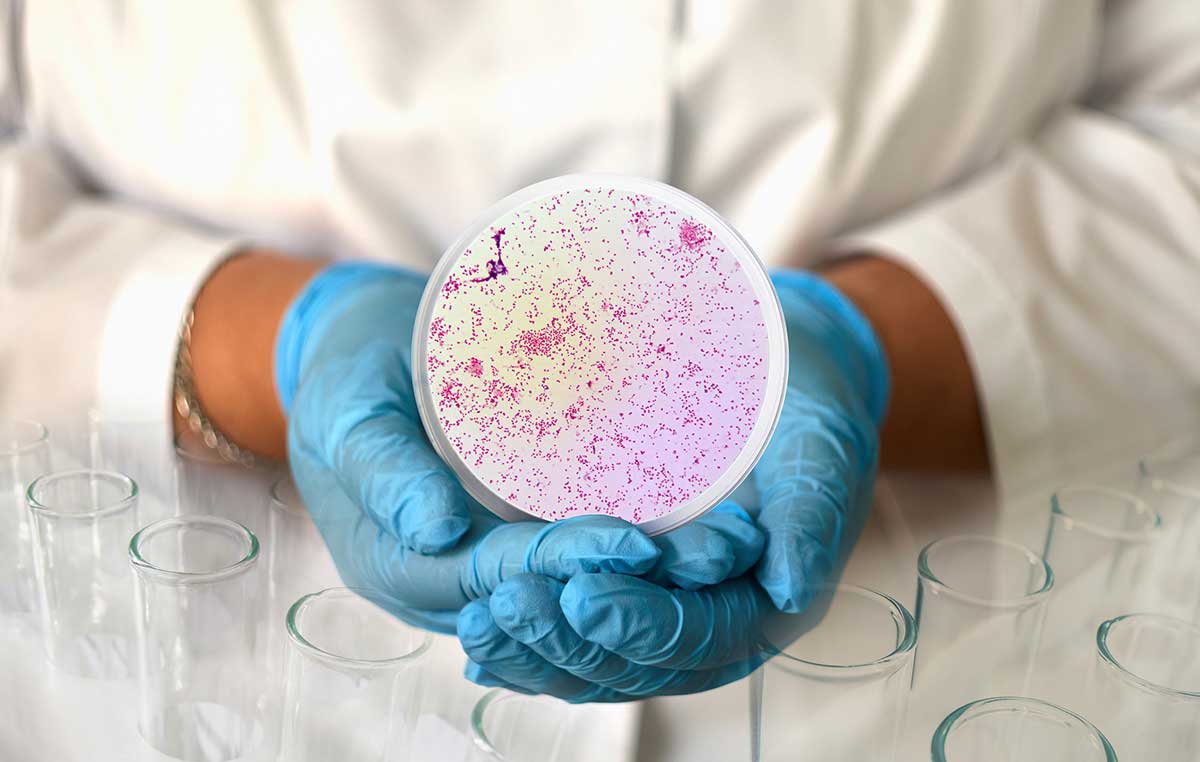 Petri dish - Antimicrobial stewardship, rapid PCR and STI
